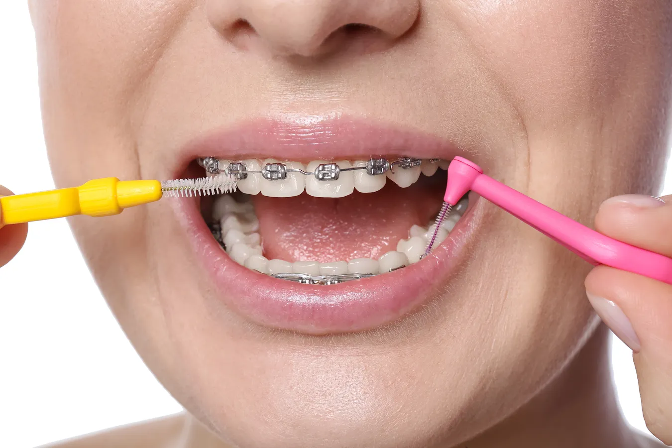 Leczenie kanałowe czy boli?