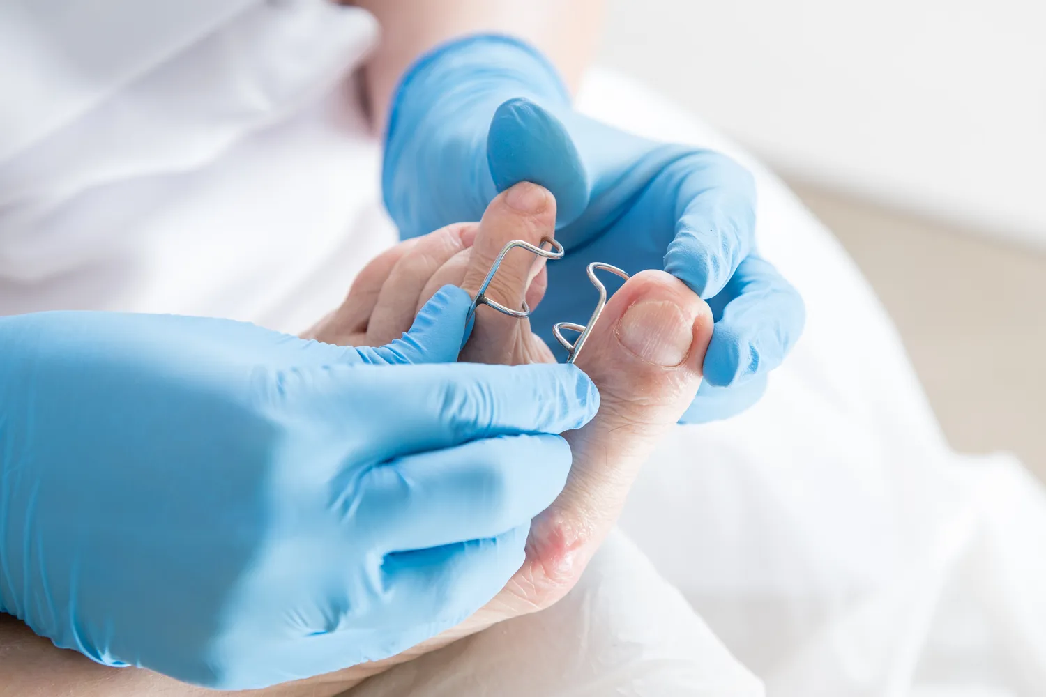 Podologia co to znaczy?