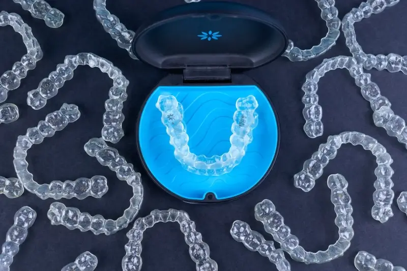 Dlaczego warto wybrać leczenie Invisalign?