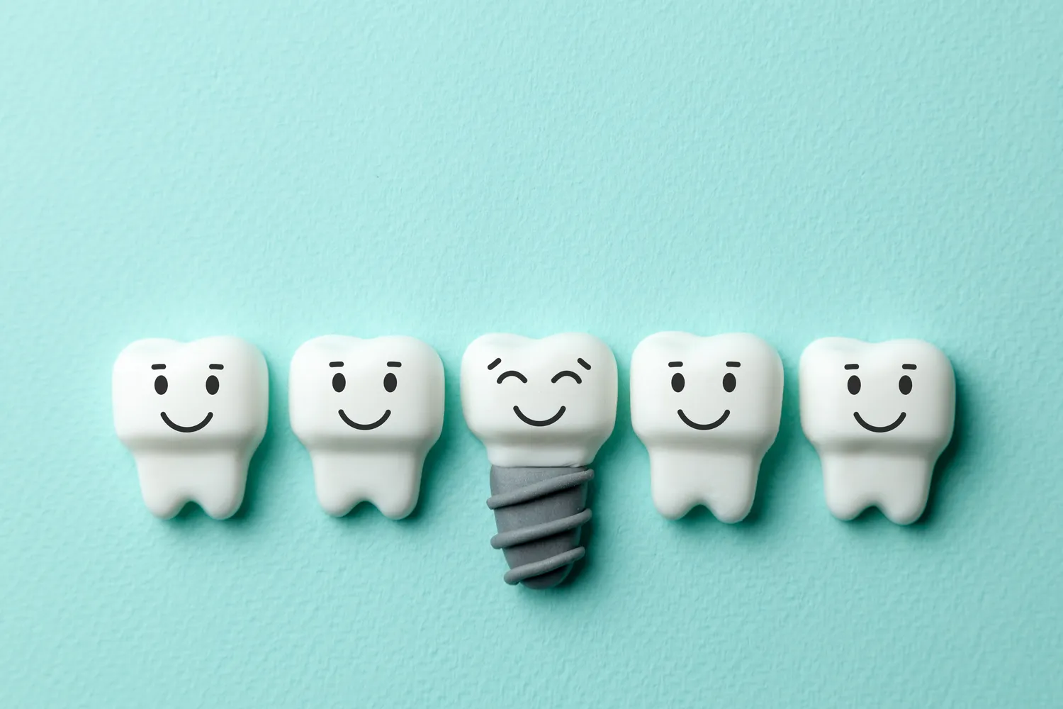 Ile wytrzymują implanty zębowe?