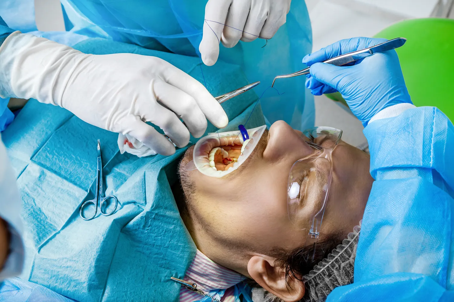 Implanty zębów Łódź gdzie najlepiej?