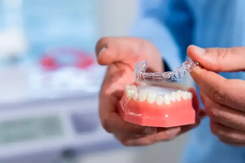 Invisalign ile kosztuje?