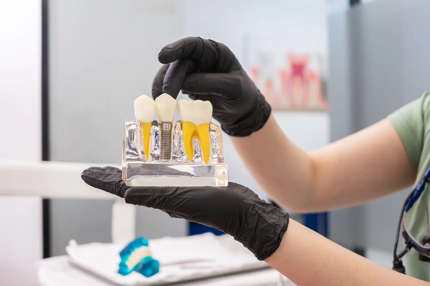 Kto wstawia implanty zębowe?