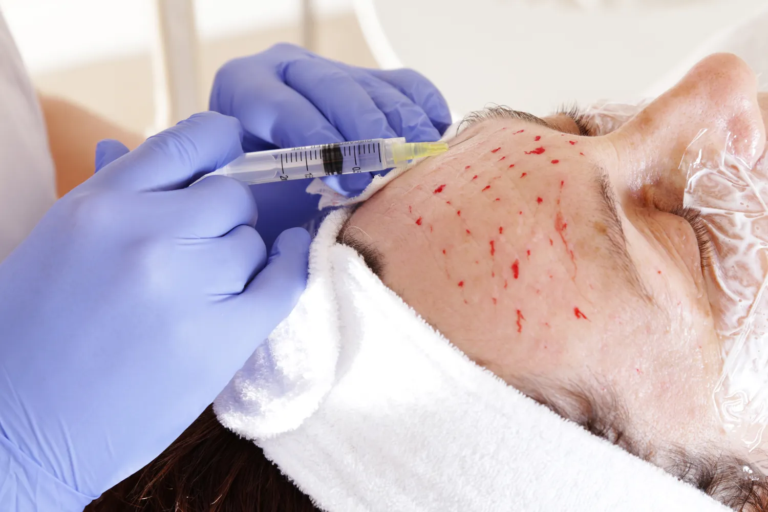 Medycyna estetyczna co trzeba skończyć?